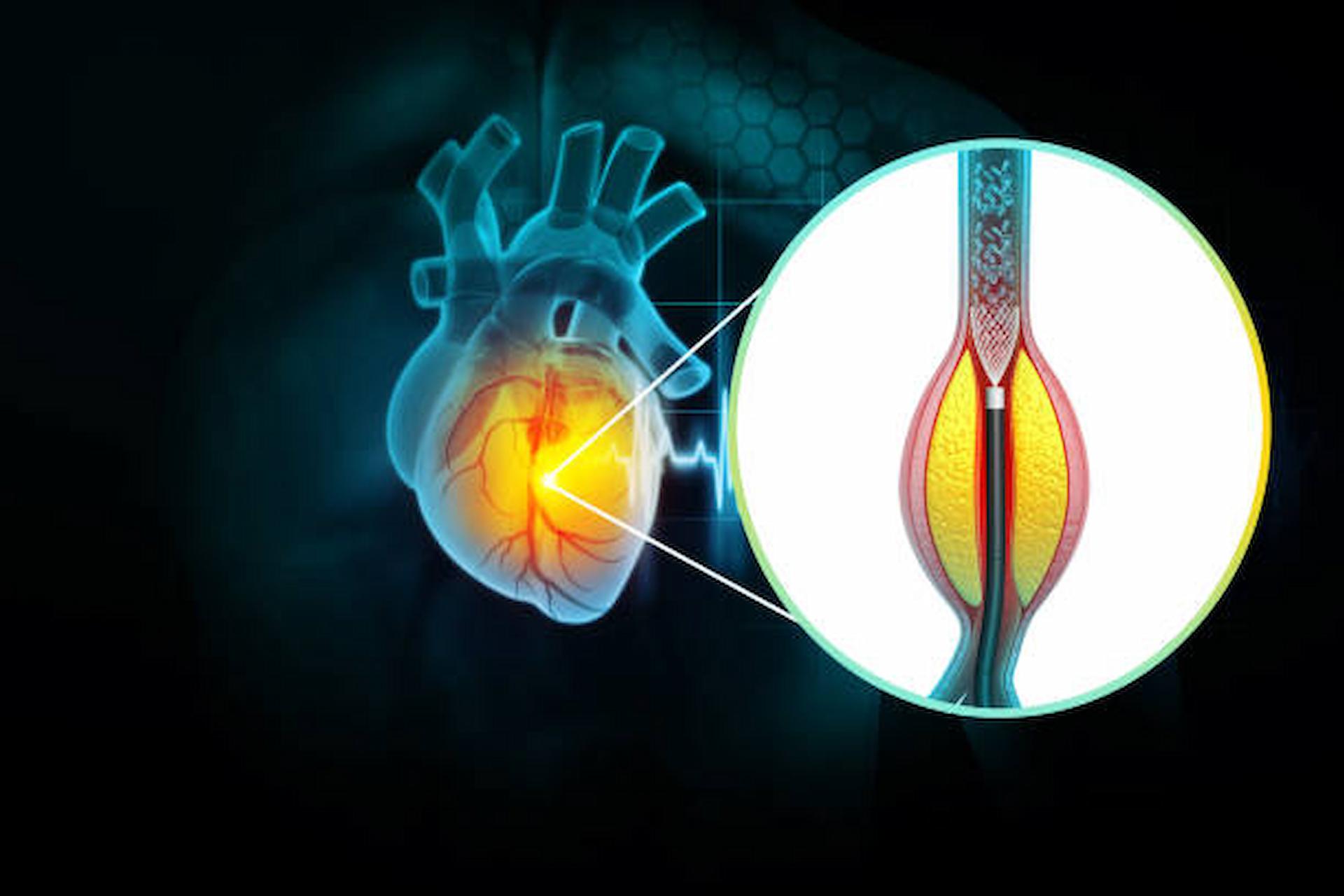 the-causes-and-symptoms-of-angina-a-type-of-chest-pain